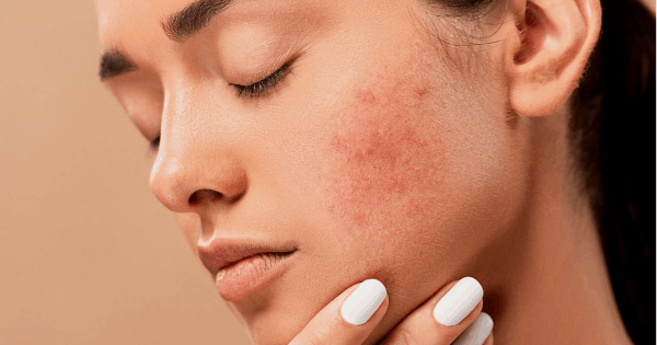 Dr. Ismat Ara Khan | Skin Joy Clinic Newtown Kolkata expert