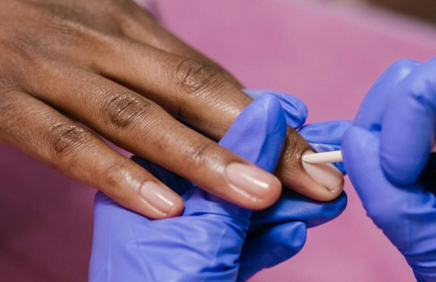 Advanced Nail Treatments by dr ismat ara khan