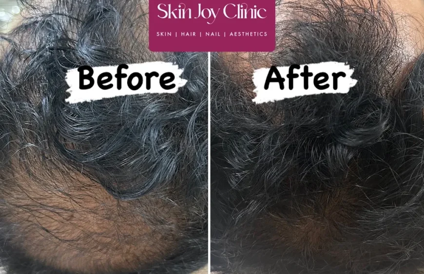 Dr. Ismat Ara Khan | Skin Joy Clinic Newtown Kolkata expert