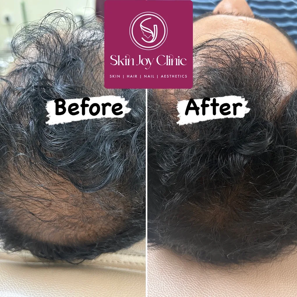 Dr. Ismat Ara Khan | Skin Joy Clinic Newtown Kolkata expert