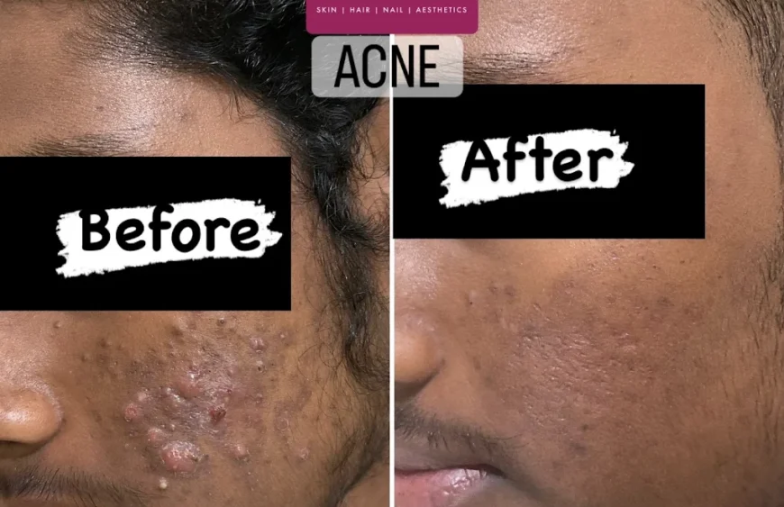 Dr. Ismat Ara Khan | Skin Joy Clinic Newtown Kolkata expert