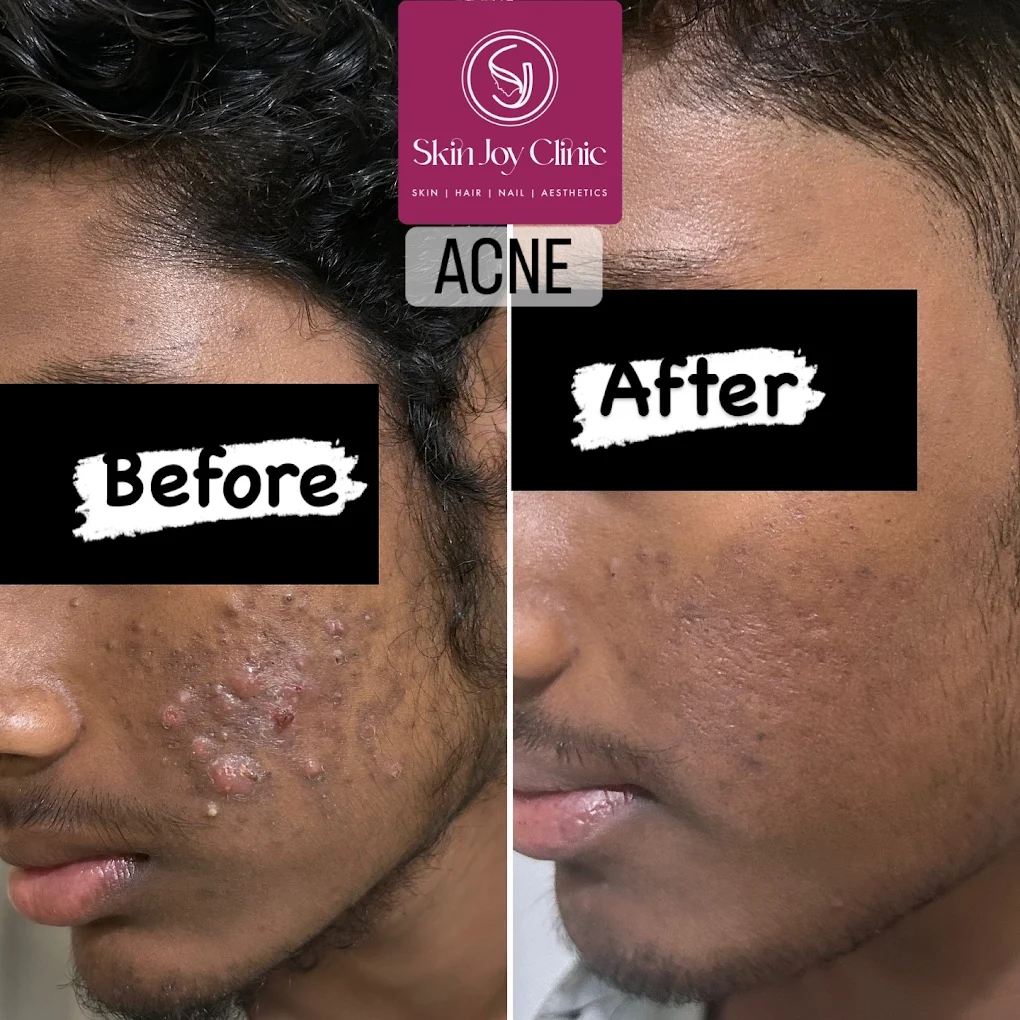 Dr. Ismat Ara Khan | Skin Joy Clinic Newtown Kolkata expert
